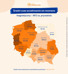 Średni czas oczekiwania na rezonans magnetyczny – NFZ vs. prywatnie
